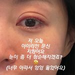 한예슬, 결혼 앞두고 <b>문신</b> 지웠다 "너무 아파서 엉엉 울어"