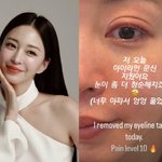 "아파서 울어" 한예슬, 아이라인 문신 제거 실시간 공개