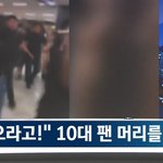 경호원이 팬 <b>뇌진탕</b> 시켜서 뉴스나옴