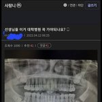 사랑니 2개있는데 이럴까봐 개무서움