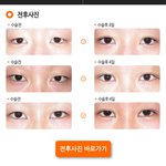[댓글부탁해] <b>쌍수</b>하면 원래 이래?