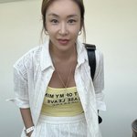 배윤정, <b>모발</b>이식 후 뜻밖의 부작용 고백 "어떻게 해결 안 되겠죠...