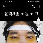 드라마 <b>비포</b>앤애프터성형외과 급인데