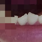 이거 <b>덧니</b> 맞는지 봐주라