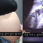 36주 낙태 유튜브 영상, '사실'… 유튜버 및 <b>집도의</b> 살인혐의...