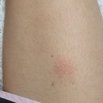 피부<b>의료</b>쪽 잘 아시는 분 저 ㅈ된건가요?