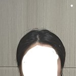 [댓글부탁해] 나 얼굴형 개망햇는데 시술 뭐해야됨??