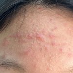 [댓글부탁해] 얘들아 집단지성의 힘이 필요해… (피부사진주의)