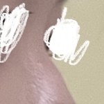 코에 있는 이런 <b>뼈선</b>? 은 뭔 수술해야됨?