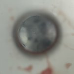 혐주의 <b>양치</b>히다피낫는데