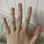 아니 야 나 이거 <b>조현</b>병인가 급함