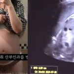 낙태 태아, 사산증명서 제출 후 화장 <b>처리</b>로 살인 혐의 입증에 난항