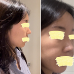 수술 잘못한 병원이 오히려 겁을주고 있습니다(사진있음+)