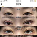 <b>이</b> <b>눈</b>은 쌍꺼풀 얇은거임 머임???