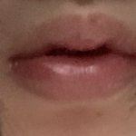 [혐주의] 입술 오무릴때 주름이 진짜 너무 심한데