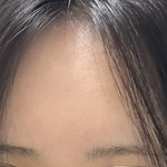<b>이마</b> 넓은편임?