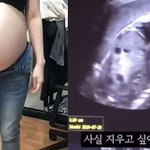 '36주 낙태' 유튜버와 <b>의료진</b> 출국금지… 살인 혐의로 입건