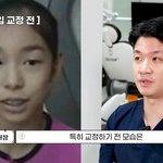김연아, 최고 수준의 <b>치아</b>교정