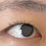 <b>쌍수</b> 잘알잇으면 조언좀