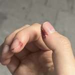 [댓글부탁해] 얘들아 내 손은 보면 무슨 생각 듦?(혐주의)