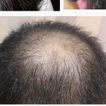 너넨 남친이 <b>평소</b>에 가발 쓰고 다녀서 몰랐는데