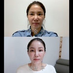 [어케생각해] 50살이 얼굴에 천만원 태우는거