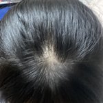 나 <b>정수리</b> 많이 휑해보여??