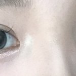 [댓글부탁해] <b>뒷</b>트임<b>밑</b>트임 할까말까