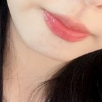 [드루와] <b>입술</b>필러 턱<b>끝</b>필러 맞음