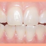 [댓글부탁해] 너네 턱에 힘빼고 편한 상태로 들어와봐