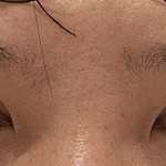 <b>남자</b> <b>쌍수</b> 40일차인데 어때?