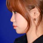 [드루와] 김채원 <b>옆모습</b>은 진짜 아쉬운듯..ㅠㅠ