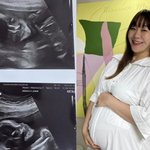 '1월 출산' 정주리, '5번째 아들' 초음파 사진 공개 "참...