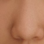 [댓글부탁해] <b>코</b>성형 ㅊㅊ좀