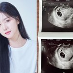 <b>라붐</b> 해인, 두 아이 엄마 된다 "빨리 찾아온 우리 둘째"[공식]