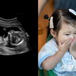 "진짜 돈 더 벌어야 돼" '<b>시하</b>'도 입틀막 래퍼 비와이, 둘째...