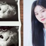 <b>라붐</b> 해인, 출산 4개월 만 임신…“빠르게 찾아온 둘째”