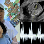 비와이 “이제 진짜 돈 더 벌어야” 둘째 생겼다…첫째 딸도 ‘깜짝’