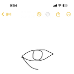 몽고<b>주름</b> 앞트임으로 없앨수잇음???