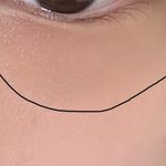 나 다크<b>서클</b>ㅈㄴ심함
