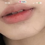 나 <b>턱</b> <b>이런</b>데 ㄹㅇ 스트레스 받음