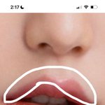아토피 있는 애들 있음? 이거 아토피임?