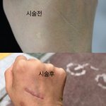 의사가 <b>의료</b>사고 내고  “돈 뜯고” 싶으면 소송하래요