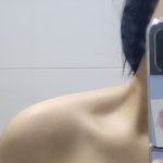 승모근 이 정도면 없는거야..??