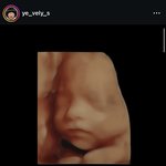 [댓글부탁해] 헐 고딩엄빠 <b>예솔</b>이네 둘째 생겼네