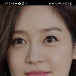 <b>복코</b>면 무조건 수술해야함?