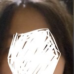 교정 하고 얼굴형 달라진 사람 나와봐 ㅜ