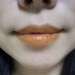 [이것좀봐줘] 몽골립밤 요오드 <b>소독</b>약색