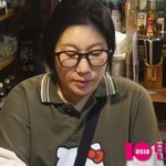 [단독] 김영희, 500원 크기 원형탈모 생겼다…"스테로이드 주사...
