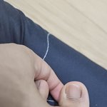 방탈죄송/ <b>일반</b> 피부과에서 조직검사가능한가요?